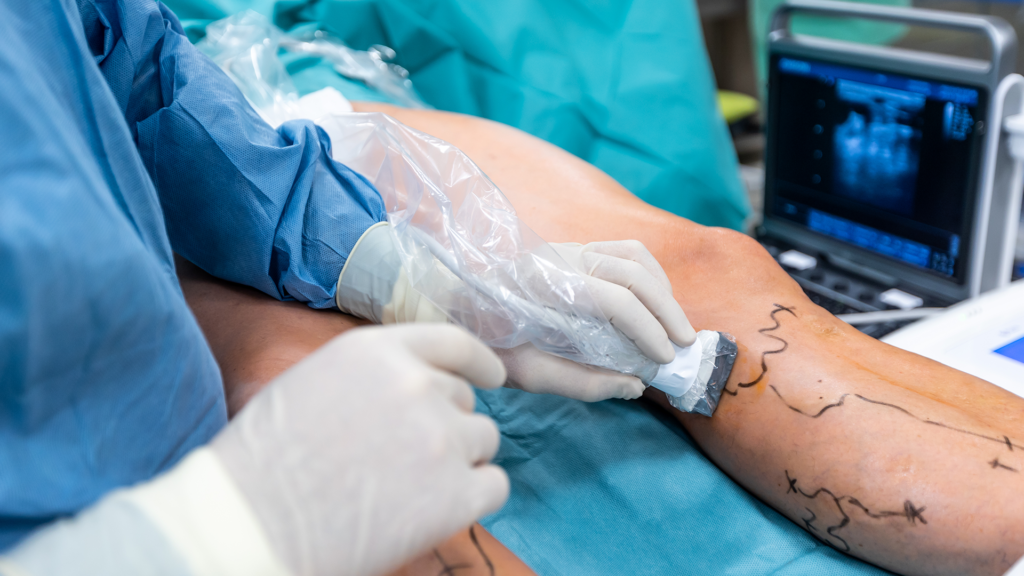 Angiologista em BH: Cuide da Saúde Vascular com a BH Consulta