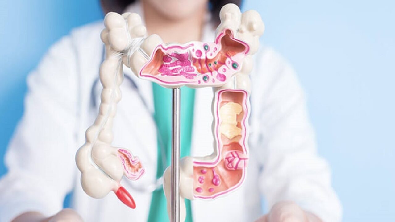 As principais doenças tratadas pelo Proctologista