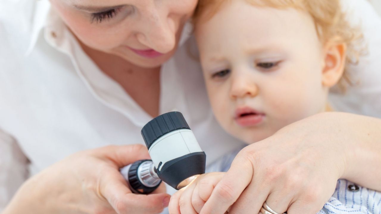 Dermatologia para crianças