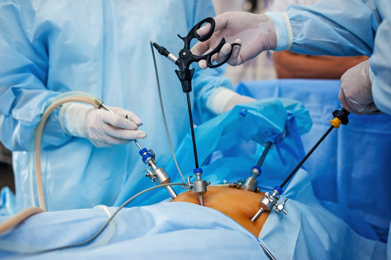 cirurgia minimamente invasiva
