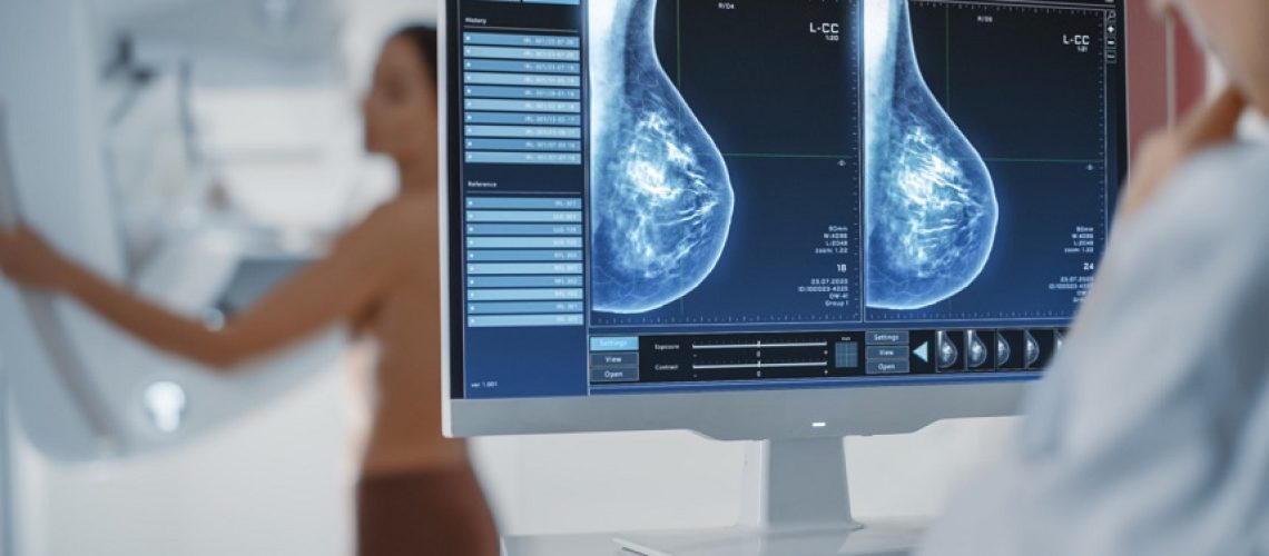 Cuidando da sua Saúde: A Importância da Mamografia na Prevenção do Câncer de Mama