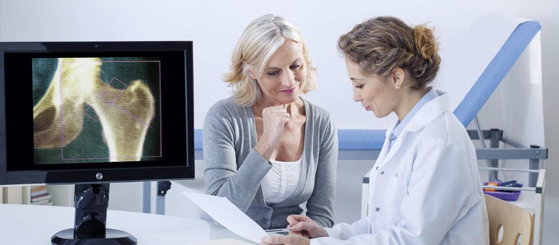 Osteoporose na Menopausa